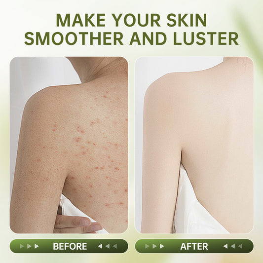 Exfoliating Body Scrub – Deep Clean, Brighten & Smooth Rough Skin