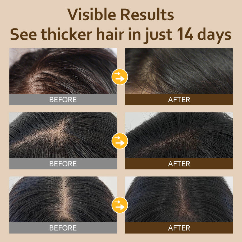 VETES Ginger Strengthening Shampoo – Nourish Roots, Reduce Hair Fall